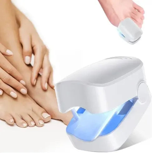 NailClean Pro: Tecnología Láser de Nueva Generación para la Salud de tus Uñas