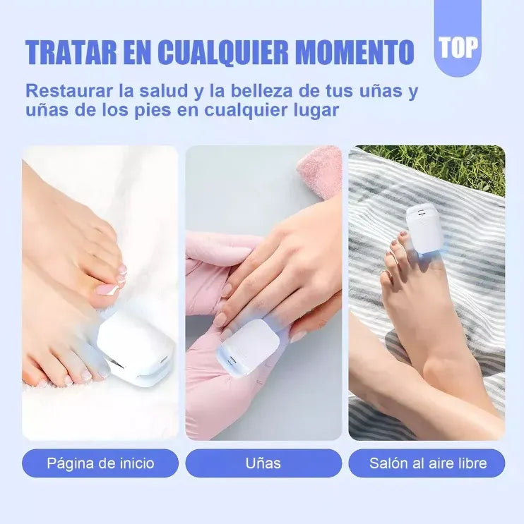 NailClean Pro: Tecnología Láser de Nueva Generación para la Salud de tus Uñas